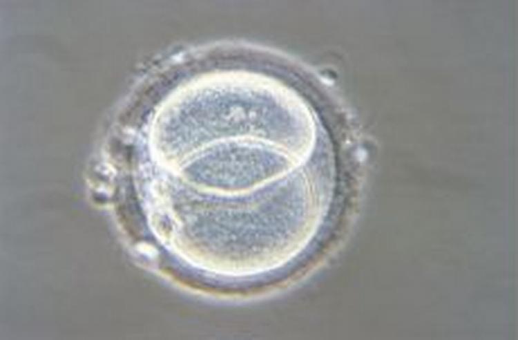 En menneskelig ægcelle 24 timer efter befrugtning. Paul Rainsbury udtager en celle fra embryoen efter to døgn for at analyse kønnet på fosteret. - Arkivfoto: Polfoto 
