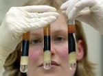 Hvis resultatet af en hiv-prøve er positiv, vil Sundhedsstyrelsen registrere den smittede i et nyt system, der sikrer en høj grad af anonymitet. - Arkivfoto: AP 