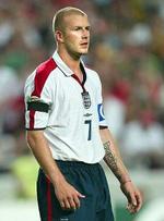 David Beckham gav grønsværen skylden for sin afbrænder. - Foto: AP 