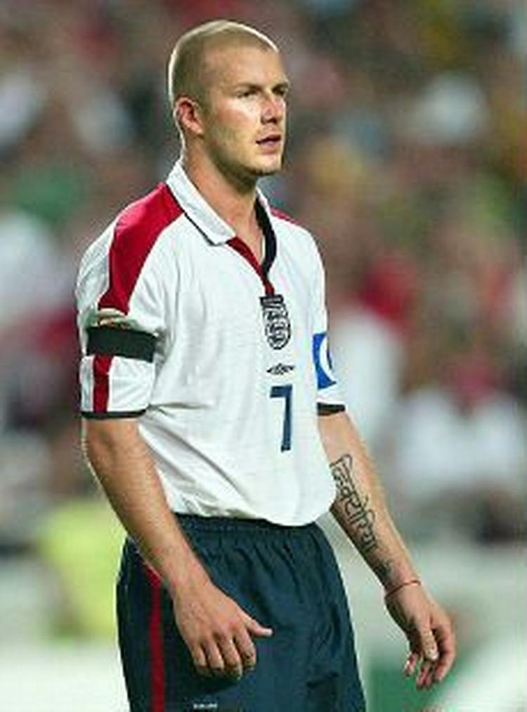 David Beckham gav grønsværen skylden for sin afbrænder. - Foto: AP 