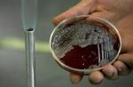 Bakterierne kan blive resistente over for antibiotika. - Arkivfoto: AP 