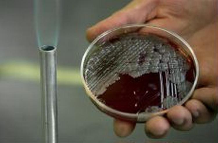 Bakterierne kan blive resistente over for antibiotika. - Arkivfoto: AP 