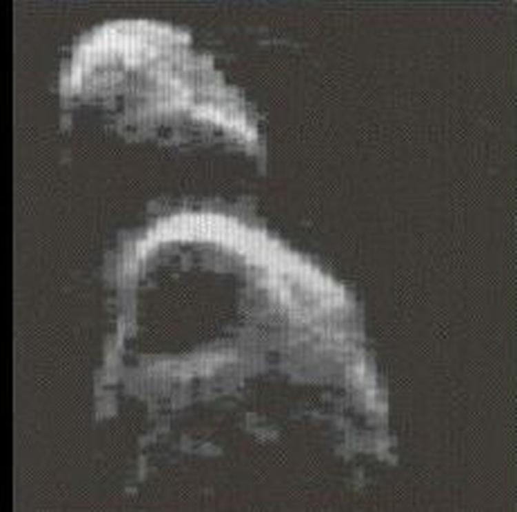 Radarbilleder af Toutatis fra december 1992 i en afstand af 4. mio. km fra Jorden. Krateret, som tydeligt ses øverst til højre, er 700 meter i diameter. - Foto: NASA 