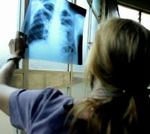 Lægerne er ikke gode nok til at informere patienterne om bivirkninger. - Arkivfoto: Thomas Borberg 