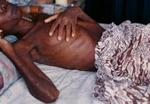 Hiv/aids er en dræber, der breder sig hurtigst i Afrika, Østeuropa og Asien. - Foto: Jesper Strudsholm 