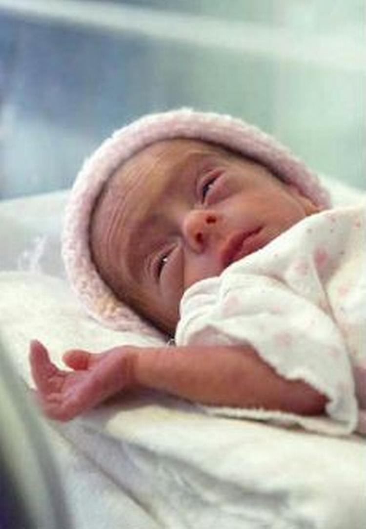 Eliza Maria vejede kun 1,4 kilo ved fødslen fem uger før tid. Men ifølge lægerne trækker hun vejret normalt. - Foto: AP 
