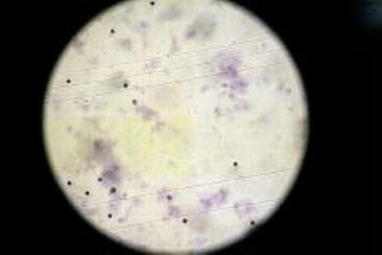 Et kig ind i mikroskopet hos stamcellebanken Copygene. - Arkivfoto: Thomas Borberg 