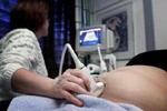 Danske forældre bebrejder lægerne, at de får mongolbørn. Lægerne mener, at det er for svætr at trænge igennem til de vordende forældre - Foto: AP 