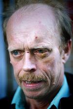 Lokalpolitikeren Hans Jørgen Vad (EL) blev overfaldet af formentlig højreekstremistiske fodboldfans - Foto: Esben Nielsen 