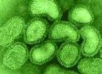 Et billede af den døelige H5N1-virus, her fra et laboratorie i Tyrkiet. - Arkivfoto: AP 