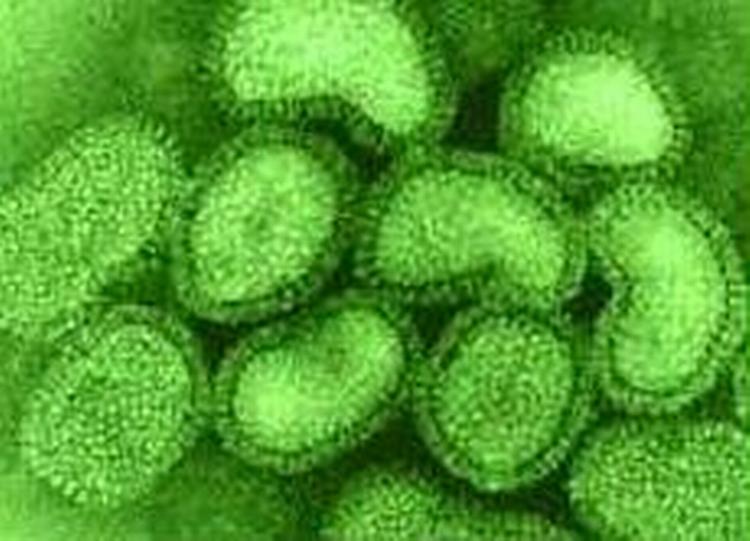 Et billede af den døelige H5N1-virus, her fra et laboratorie i Tyrkiet. - Arkivfoto: AP 