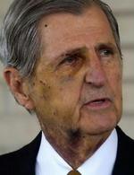 En arret Harry Whittington mødte pressen fredag. - Foto: AP 