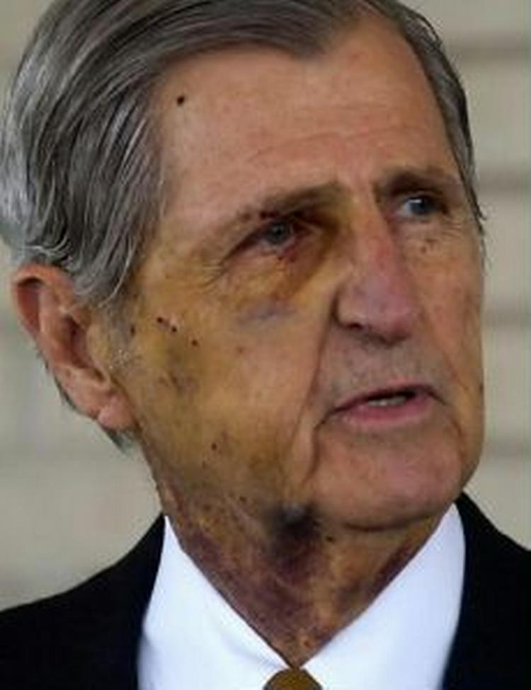 En arret Harry Whittington mødte pressen fredag. - Foto: AP 