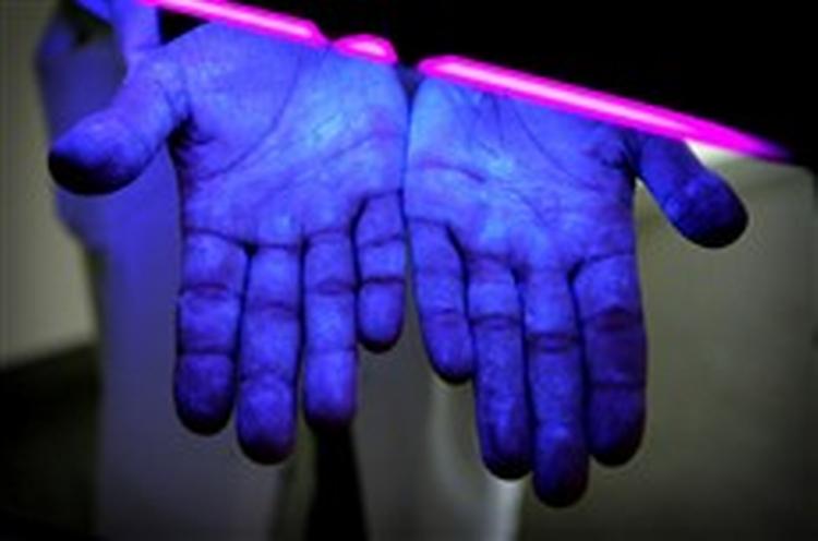 Hvidovre Hospital har et apparat, der med ultraviolet belysning kan afsløre, hvilke områder på hænderne der er tilstrækkeligt afvasket. De lyse områder er gnedet ind i sprit   men de mørke er ikke sprittet tilstrækkeligt.   Foto: Jens Dresling 
