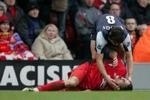 Daniel Agger i græsset efter en hård takling fra Citys Joey Barton. Stemplingen har nu ført til, at Agger har måttet melde afbud til onsdagens U21-landskamp. - Foto: AP 