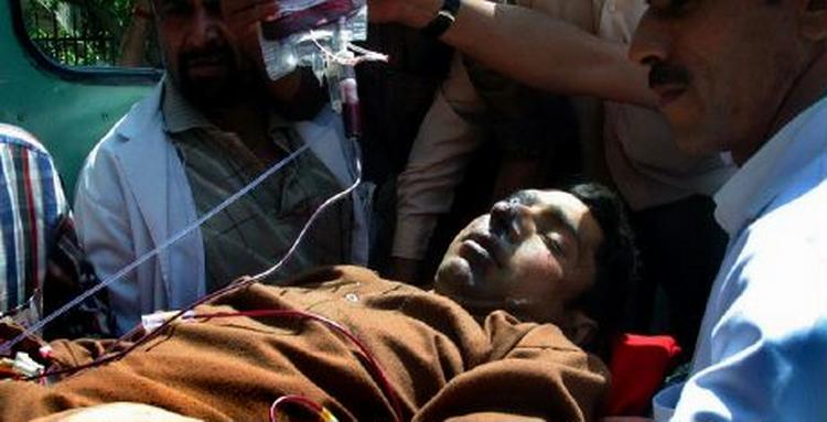 Et offer modtager lægehjælp efter ukendte gerningsmand skød mod hinduer i en landsby i Kashmir. - Foto: AP 