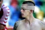 Daniel Agger fik en flænge over det ene øje i kampen mod Holland. - Foto: Thomas Wilmann 