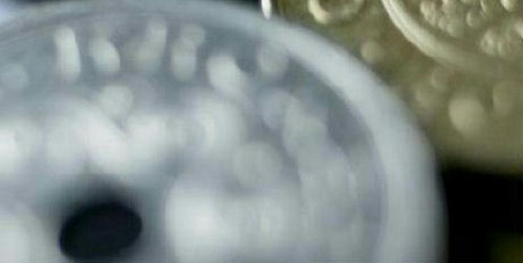 Torturcenter kræver 85.000 kroner for to timers gruppeterapi - Foto: Thomas Borberg 