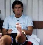 Milan Baros og den skadede fod. - Foto: AP. 