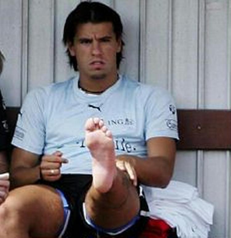 Milan Baros og den skadede fod. - Foto: AP. 