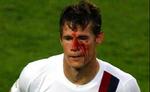 Brian McBride har fået en personlig undskyldning fra Daniele De Rossi. Spørgsmålet er nu om italieneren kan slippe udenom en længere karantæne. - Foto: AP 