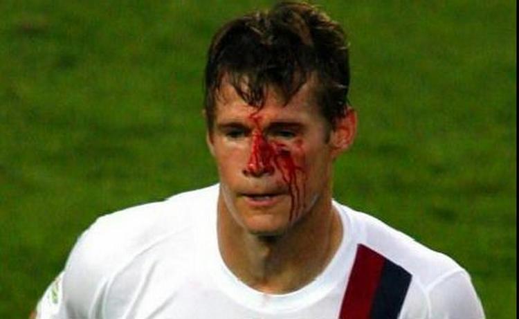 Brian McBride har fået en personlig undskyldning fra Daniele De Rossi. Spørgsmålet er nu om italieneren kan slippe udenom en længere karantæne. - Foto: AP 