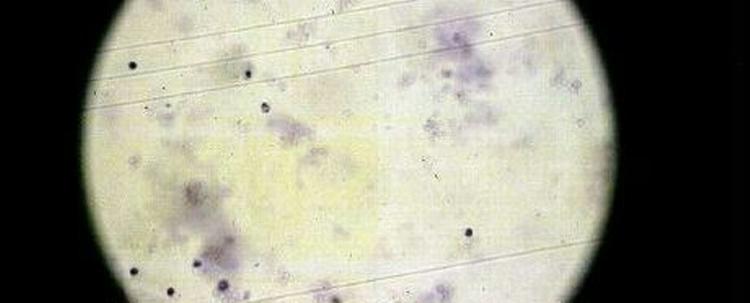 Det er lykkedes forskere at bringe mus til verden ved brug af kunstig sperm - Foto: Thomas Borberg 