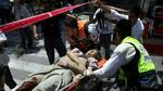En kvæstet israelsk kvinde bliver behandlet efter en raket har ramt Hizbollah. - Foto: AP 