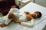 Den 6-årige libanesiske dreng Abbas Abbas på billedet, var en af de mange ofre for klyngebomber. Han havde samlet en bombe op i den tro, at det var legetøj. Bomben eksploderede i hånden på ham. 