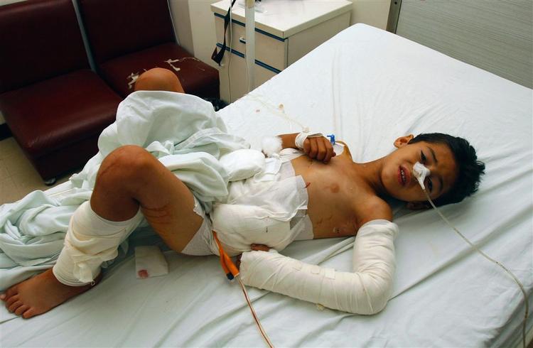 Den 6-årige libanesiske dreng Abbas Abbas på billedet, var en af de mange ofre for klyngebomber. Han havde samlet en bombe op i den tro, at det var legetøj. Bomben eksploderede i hånden på ham. 