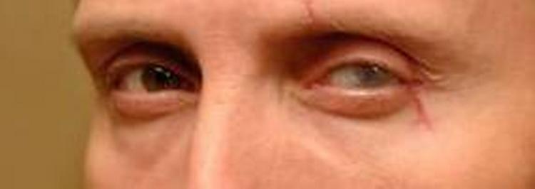 Mads Mikkelsen er overbevisende ubehagelig i rollen som Bond-skurken Le Chifre, mener de udenlandske anmeldere. 