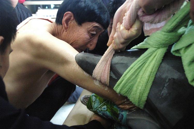 Delfinernes tænder blev dækket med håndklæder, så Bao Xishun ikke ville blive bidt under redningsaktionen. 