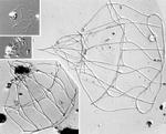 En hidtil unavngiven Choanoflagellat fra Thailand, som Helge Thomsen også har fundet i det Indiske Ocean. På fotografiet er kun huset tilbage. Nedenfor en tegning af en anden art Platypleura Acuta. Foto og tegning Helge Thomsen 