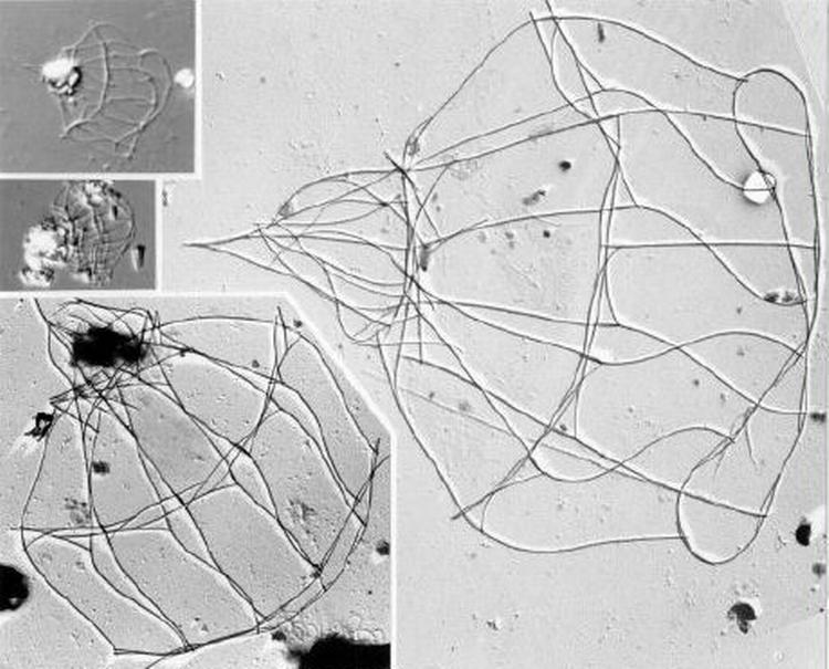 En hidtil unavngiven Choanoflagellat fra Thailand, som Helge Thomsen også har fundet i det Indiske Ocean. På fotografiet er kun huset tilbage. Nedenfor en tegning af en anden art Platypleura Acuta. Foto og tegning Helge Thomsen 