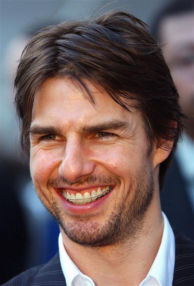Tom Cruise i 2002 - med bøjle på tænderne. 
