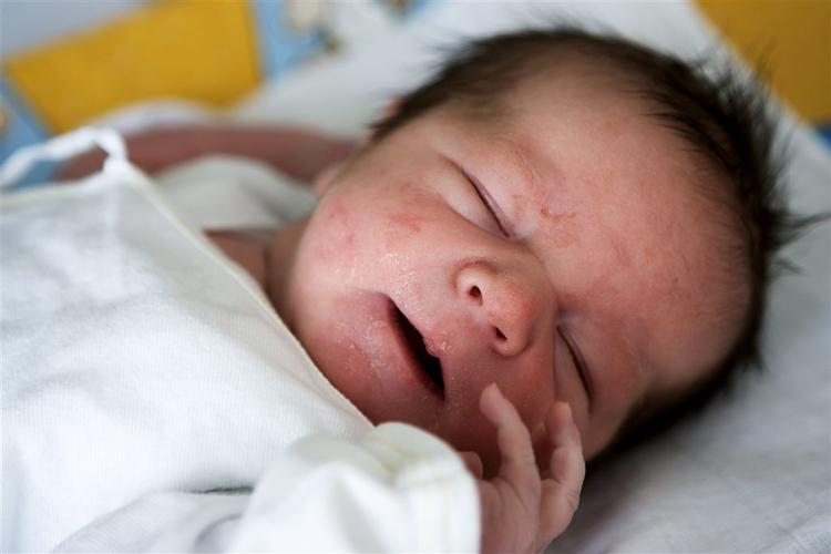 Hvorvidt en baby bliver taget ved kejsersnit, eller moderen får smertelindring, klip og ve-stimulerende stoffer, afhænger af hvor fødslen foregår. 