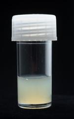 Der er ikke mangel på aftagere til en død israelsk soldats sæd. 