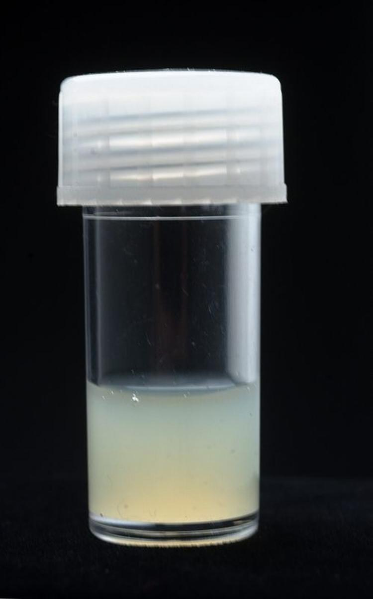 Der er ikke mangel på aftagere til en død israelsk soldats sæd. 