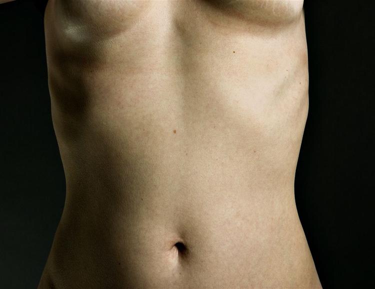 Private plastikkirurger tager sig ikke tid til at sikre sig, at deres klienter er raske. Modelfoto. 