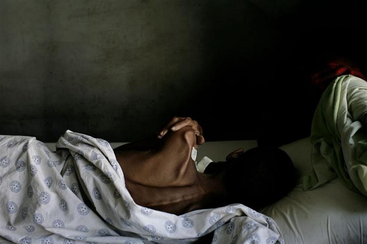 Mere end halvdelen af verdens aids-smittede lever i syd for Sahara. 