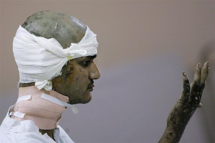 Et af ofrene for mandagens terrorbomber på toget mellem Indien og Pakistan 