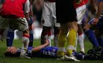 Det så slemt ud, da John Terry længe lå på grønsværen efter et hændeligt uheld. Men Chelsea-forsvareren undgik alvorlige skader. 