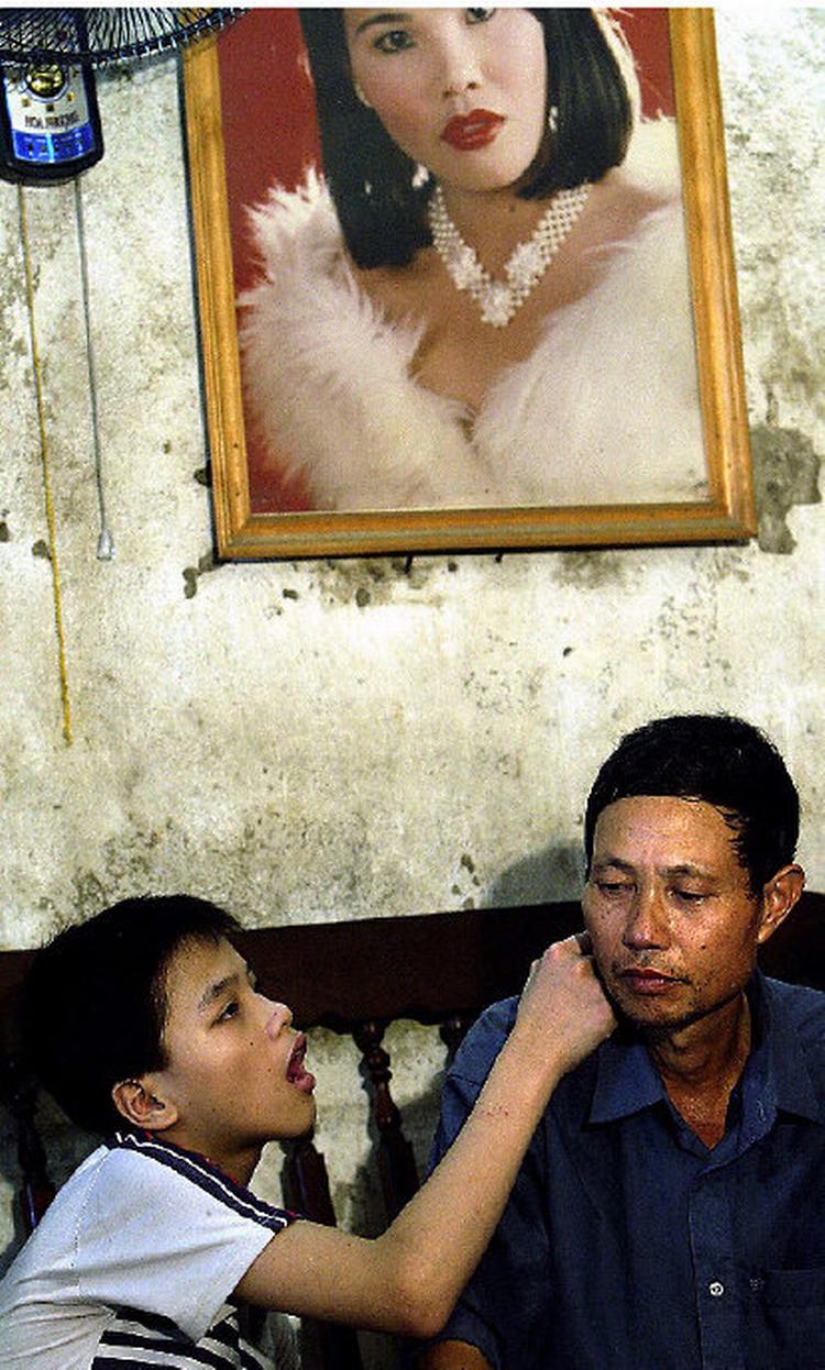 Levende historie. Vietnam lever med sin fortid tæt inde på livet. Amerikanernes brug af Agent Orange under Vietnamkrigen resulterede i masser af vanskabte børn som drengen Nguyen Quang Trung på 17 år, der her rører sin far kærligt på kinden. Foto: Richard Vogel/AP 