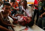 En såret palæstinenser bringes til behandling på et hospital i Gaza. 