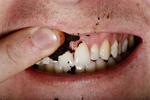 Snus