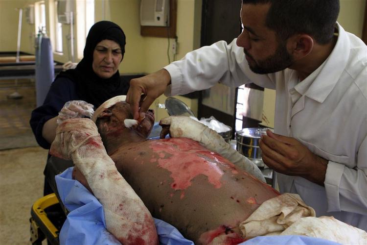 Irak mangler læger og sygeplejersker til at behandle syge og sårede. Hospitalspersonalet flygter ud af landet, fordi de frygter for deres sikkerhed. 