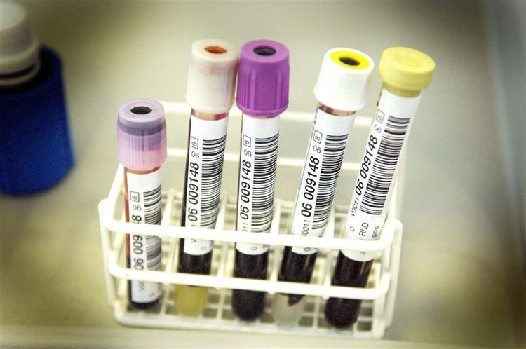 Synes du også, det er spild af penge at screene blod for hiv? Deltag i debatten nedenfor. 