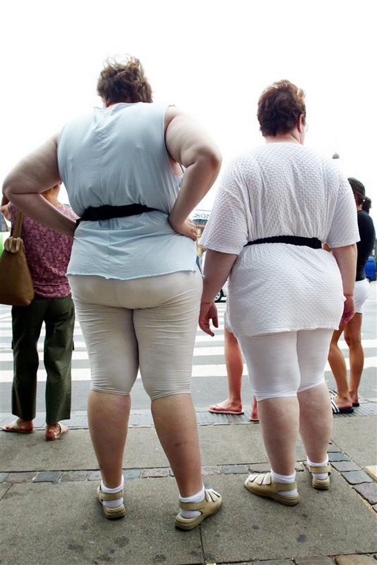 Hvert år koster de svært overvægtige samfundet 14,4 mia. kr., viser en rapport fra Sundhedsministeriet. Rapporten viser, at sygefravær koster 1,6 mia. kr., mens permanent arbejdsophør løber op i 11,7 mia. kr. Dertil kommer udgifter til sygehusindlæggelser, som beløber sig til 1,1 mia. kr. 