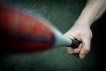 Baseball bat.