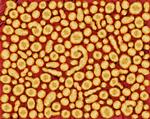 Influenzavirus. 